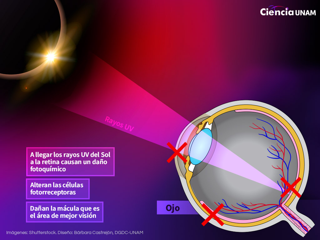 Infografía: los rayos UV del Sol llegan a la retina y causan daño fotoquímico, alterando las células fotorreceptoras y la mácula